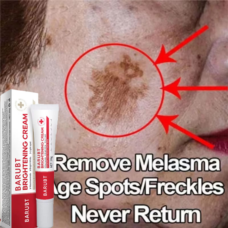 Skincare Vitamin C - Powerful Spot-removing Whitening Cream Brighten Skin