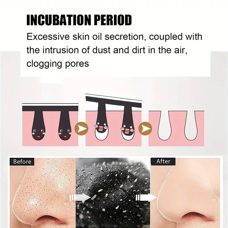 Unisex Blackhead Remove Mask N - Skincare Indonesia ulasan dan harga
