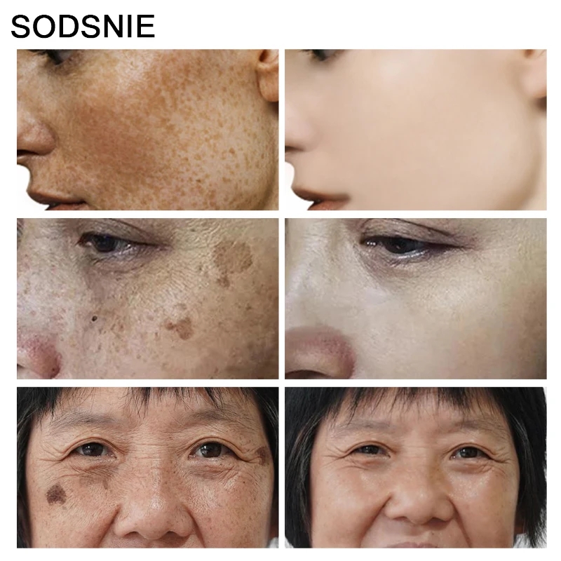 Dark Spot Remover Vitamin C Wh - Skincare Vitamin C ulasan dan harga