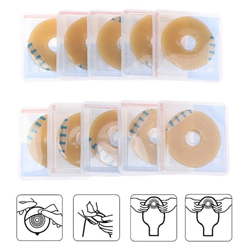 Colostomy Bag Ostomy Paste Rin - Skincare Indonesia ulasan dan harga