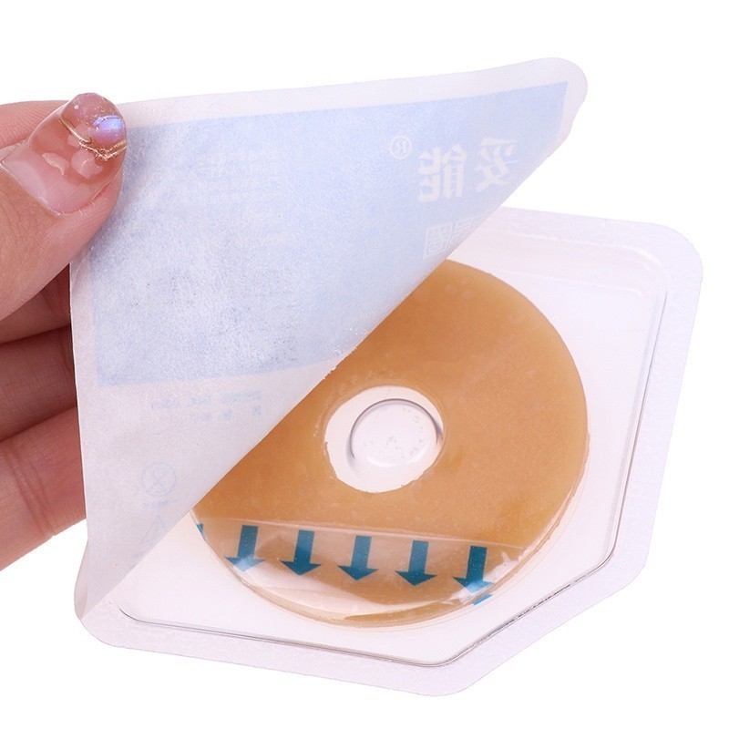 Colostomy Bag Ostomy Paste Rin - Skincare Indonesia ulasan dan harga