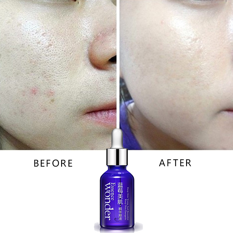 BIOAQUA Blueberry Face Lifting - Skincare Bioaqua ulasan dan harga