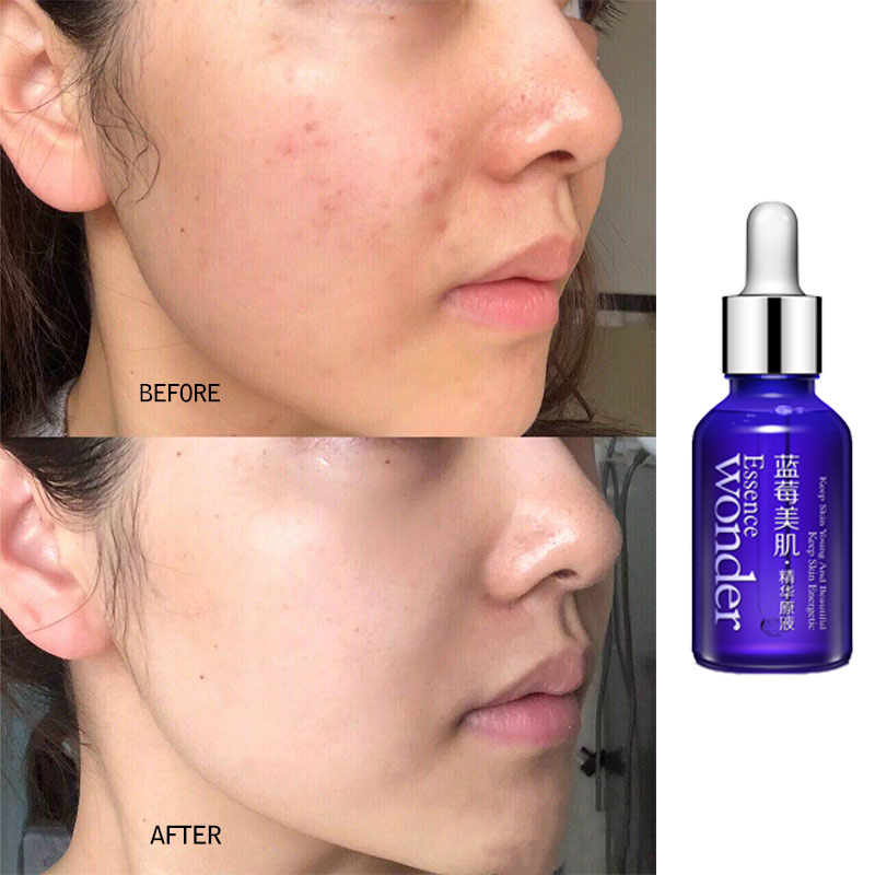 BIOAQUA Blueberry Face Lifting - Skincare Bioaqua ulasan dan harga