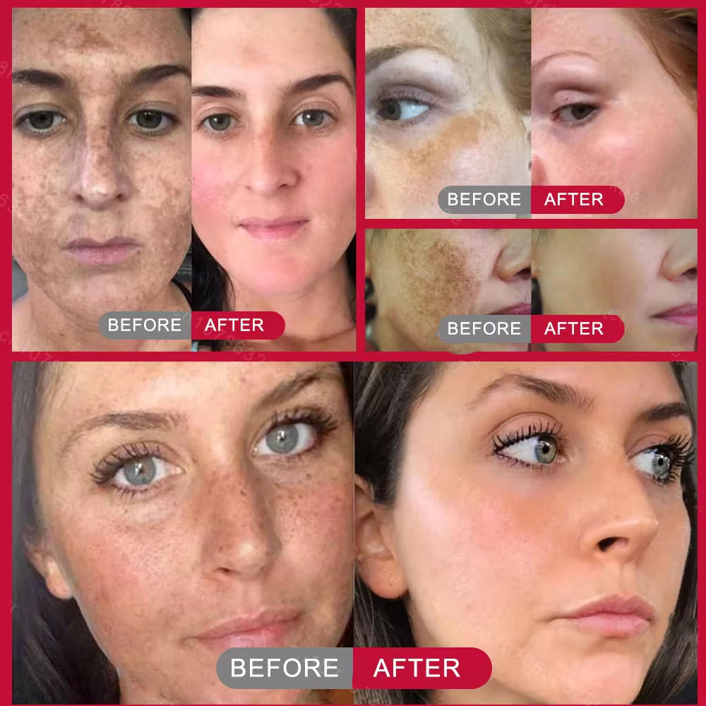 Powerful Spot-removing Whiteni - Skincare Vitamin C ulasan dan harga